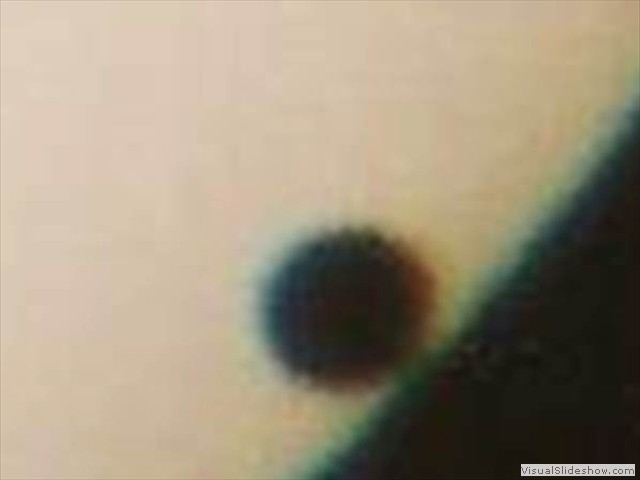 Black Drop effect - enlargement